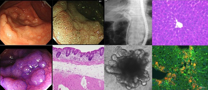 消化器疾患・生活習慣病学イメージ