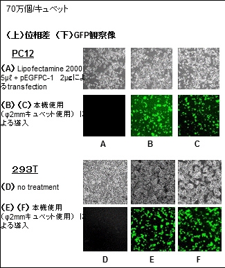 位相差とGFP観察像